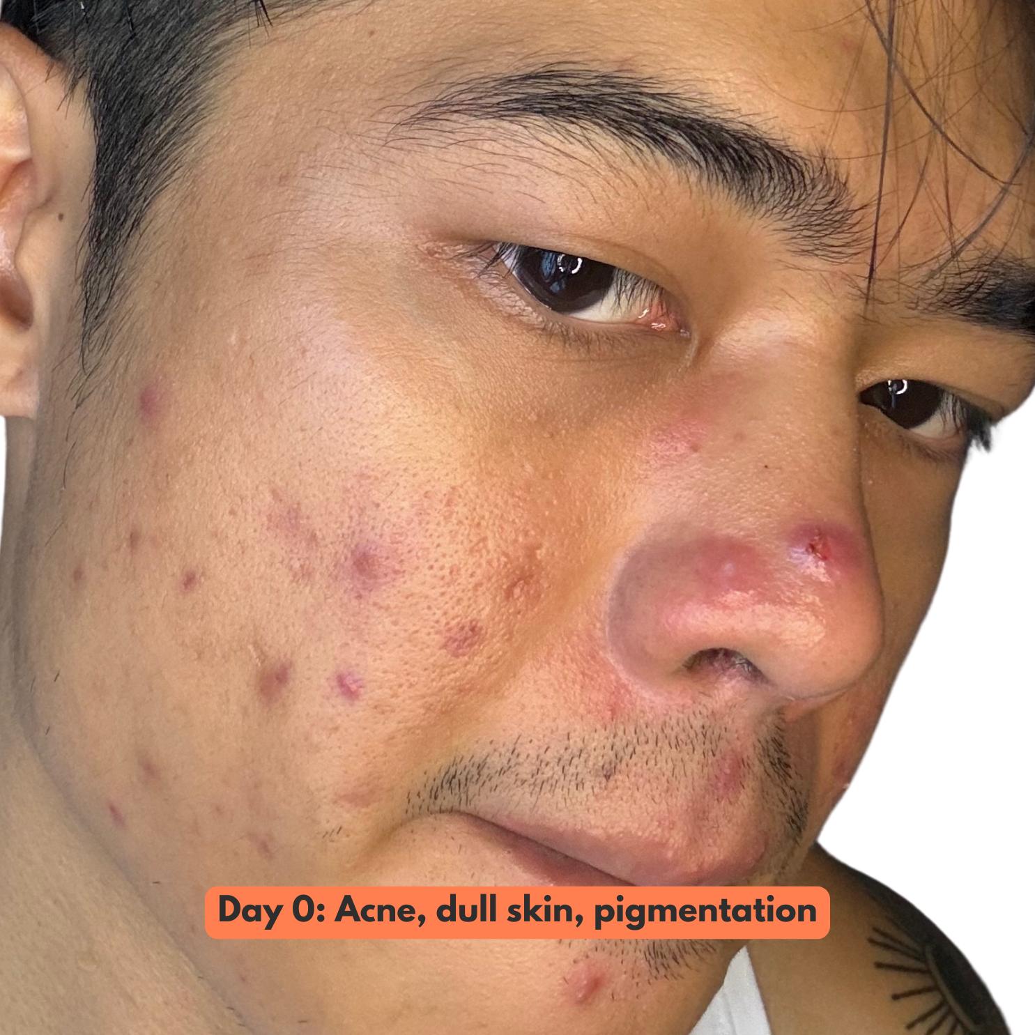 Multi-Purpose Face Solution v2