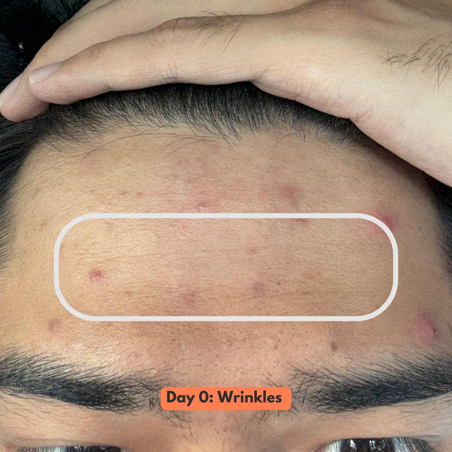 Multi-Purpose Face Solution v2